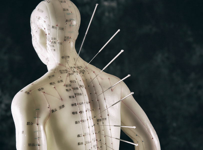 Orthomax for Acupuncture in Hamilton